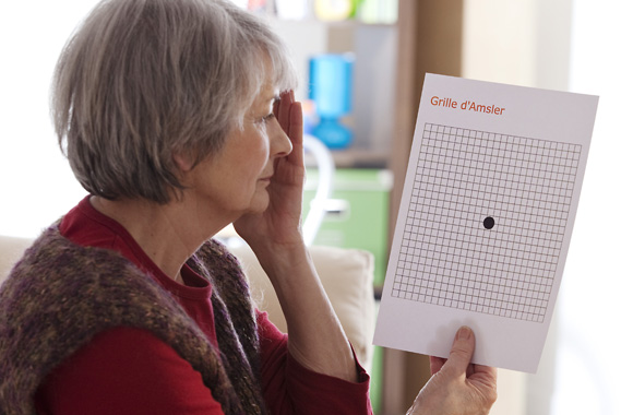 Testing for age-related macular degenerationa